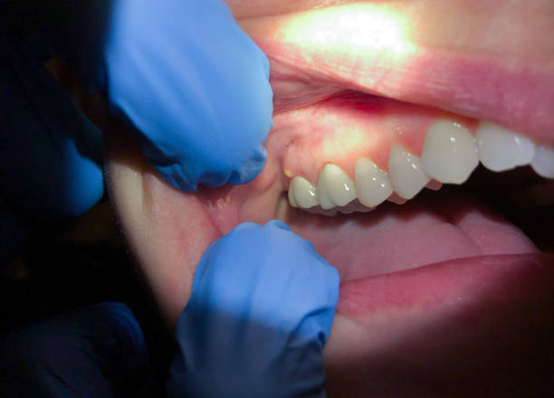 Best Weekend Emergency Dentist in Onancock, VA