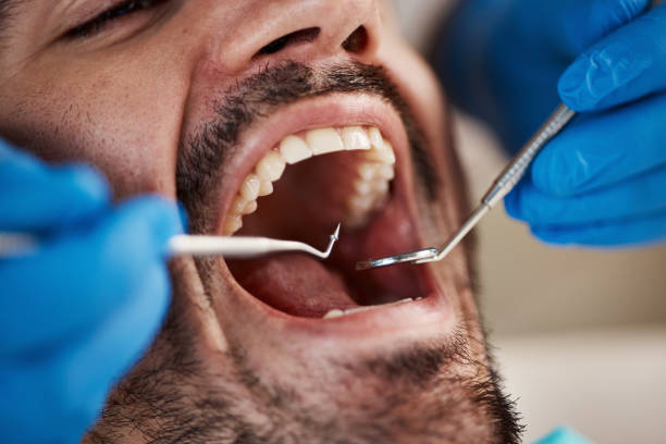 Best Emergency Dental Care for Broken or Chipped Teeth in Onancock, VA