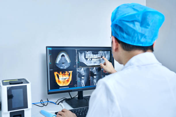 Best Emergency Wisdom Teeth Removal in Onancock, VA
