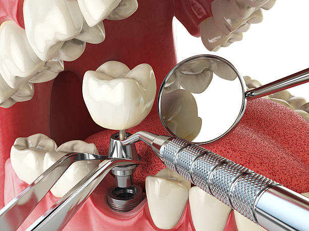 Best Emergency Gum Treatment in Onancock, VA